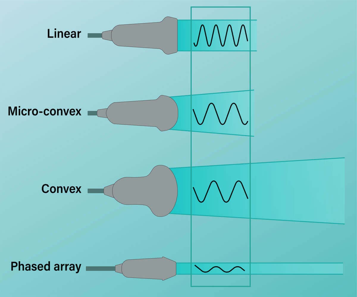 All Types of Ultrasound Transducers