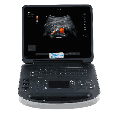 Refurbished Fujifilm Sonosite Edge II Total Ultrasound