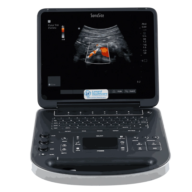 Fujifilm Sonosite Edge II Total