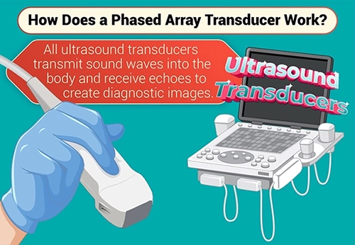 How Does a Phased Array Transducer Work?