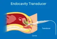 Endocavity Transducers