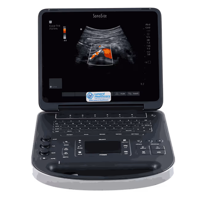 Refurbished Sonosite Edge II Total