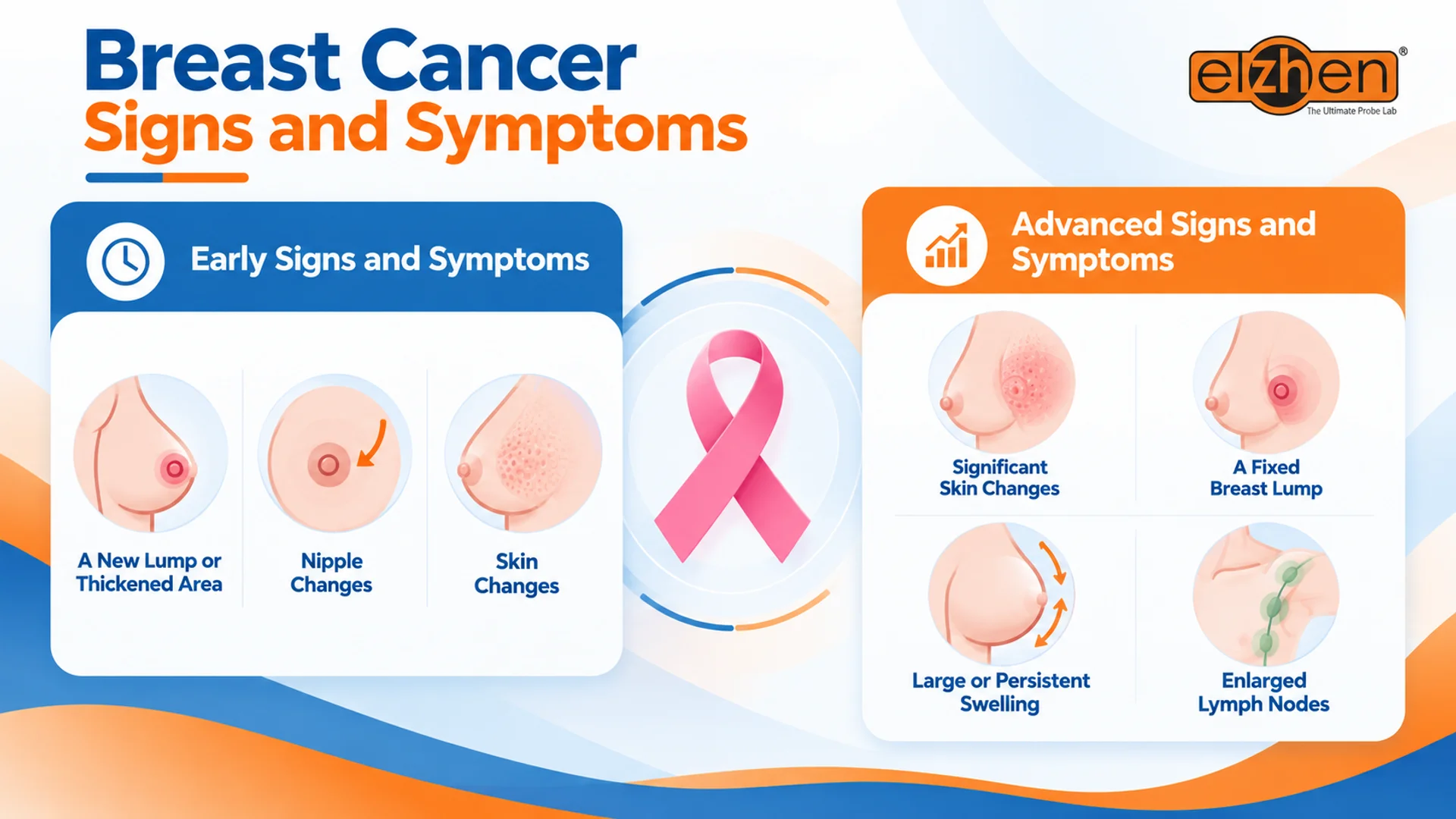 explanation of breast cancer signs and symptoms in early and advanced stages in an infographic