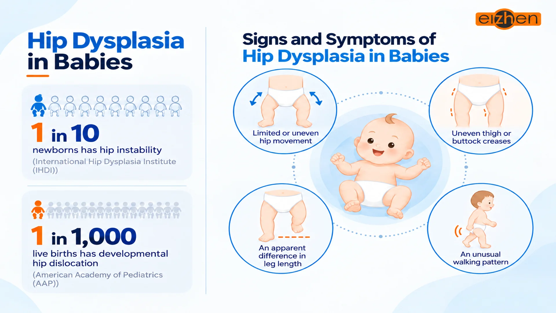 Signs and Symptoms of Hip Dysplasia in Babies