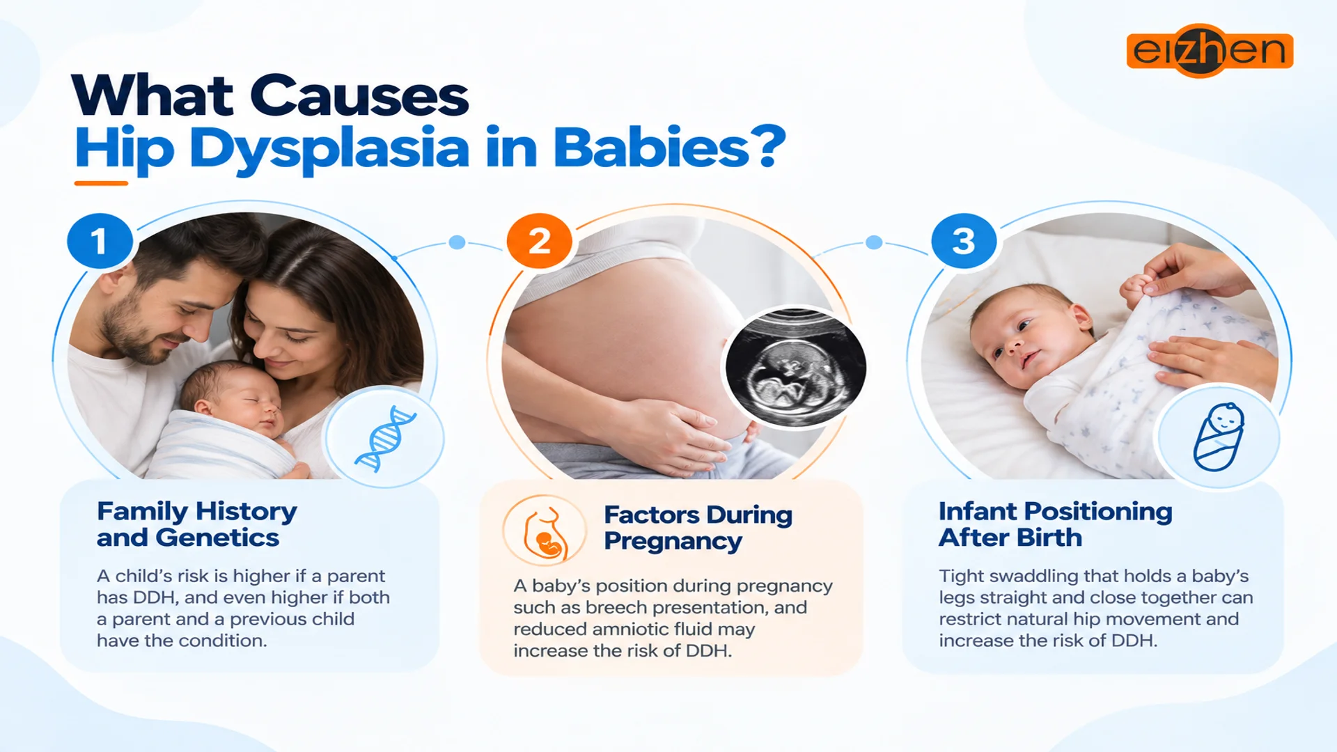 causes of baby hip dysplasia